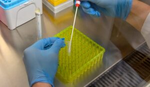 FDA approves COVID-19 saliva test developed at Yale